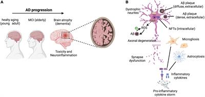 Functionalization strategies of polymeric nanoparticles for drug delivery in Alzheimer’s disease: Current trends and future perspectives